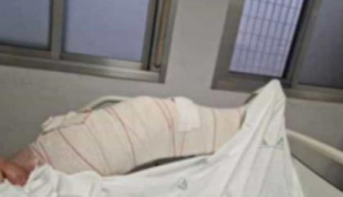 Denuncian que no hay placas ni personal para operar en el Hospital de Jerez: "Mi hermano está llorando de dolor"