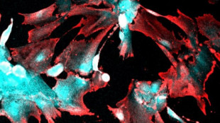 Científicos belgas encuentran una forma de bloquear la infección por covid