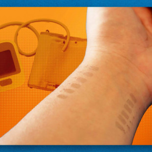 Monitoreo continuo sin manguito de la presión arterial a través de tatuajes de bioimpedancia de grafeno (ING)