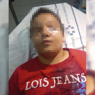 Identifican a los agresores de un niño de 11 años por defender a su abuelo en La Laguna