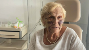 Tres jóvenes golpean a una mujer de 89 años en Francia y sus padres le ofrecen dinero para que retire la denuncia [FR]