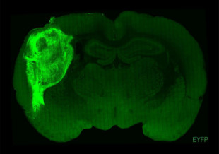 Un equipo de científicos injerta neuronas humanas en el cerebro de ratas y logra influir en su comportamiento