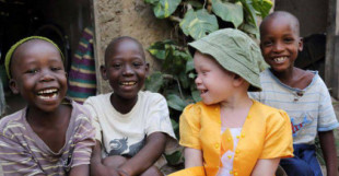 Una misteriosa ola de secuestros y asesinatos de personas albinas sacude Madagascar
