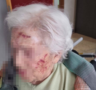 “¿Mi madre se levanta con la cara marcada y nadie nos avisa?": denuncia por agresión a una mujer de 93 años en una residencia de Madrid