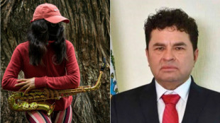 Juan Antonio Vera Carrizal: El exdiputado que ordenó quemar con ácido a la saxofonista de Oaxaca sale de la cárcel