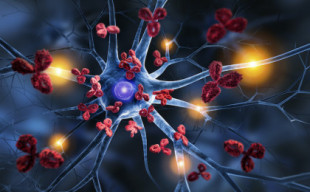 Un descubrimiento podría acabar con la inflamación en la esclerosis múltiple  (ENG)