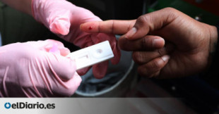 Primer caso de una mujer con VIH que se cura tras un trasplante de médula con células de cordón umbilical