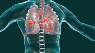 Identifican una estrategia potencial contra la metástasis del cáncer de pulmón