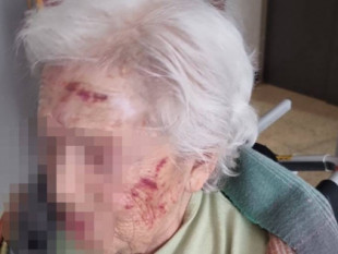 La agresión a una anciana en una residencia de Madrid se salda con 210 euros de indemnización