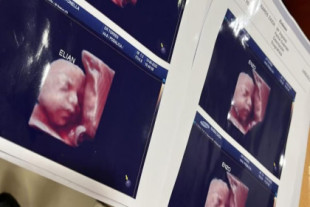 Denuncian que una clínica utilizaba la misma ecografía para todas las embarazadas