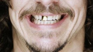 Un medicamento que regenera los dientes 'jubila' a los implantes