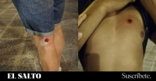 Archivan el expediente contra los policías de Granada que dispararon a un joven con material antidisturbio