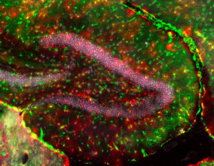 Descubierto un nuevo tipo de célula en el cerebro humano