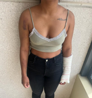 La joven a la que dos policías karatecas le rompieron el brazo tras allanar ilegalmente su casa, hospitalizada por ansiedad y sin noticias del juzgado