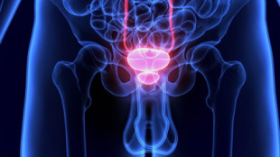 ¿La eyaculación previene el cáncer de próstata?