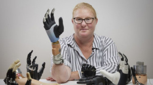 Un innovador brazo biónico que se fusiona con el esqueleto y los nervios del usuario podría mejorar la atención a los amputados