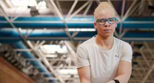 Adi Iglesias, la campeona paralímpica que acabó en un centro de menores español tras huir de la caza de los albinos en Mali
