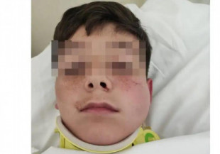Un hombre noquea a un niño de 12 años en Estepona porque le molestaba el ruido del balón