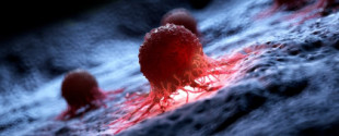 ScienceAlert: Científicos destruyen el 99% de células cancerígenas en laboratorio usando moléculas vibrando (eng)