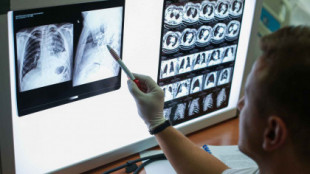 Golpe al cáncer de pulmón: la nueva tecnología del MIT para detectarlo de forma fácil y rápida