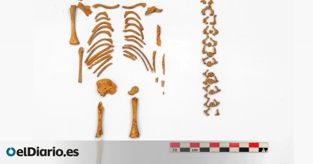 Los bebés con síndrome de Down recibían enterramientos especiales hace 5.000 años