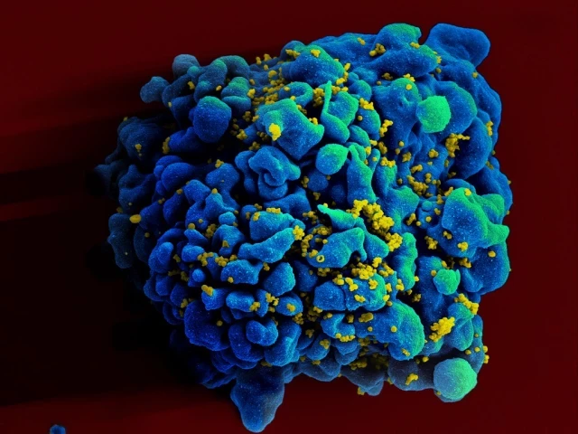 Científicos logran a través de Crispr eliminar el VIH de las células infectadas