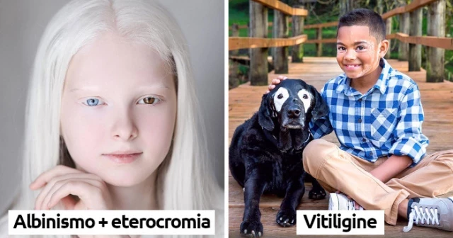 Fotografías de personas únicas por sus raras características genéticas [ITA]