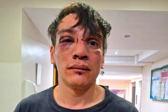 Abogado de varias organizaciones sociales es golpeado brutalmente por la policía en Argentina