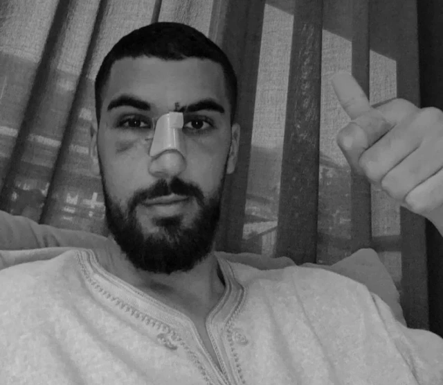 El marroquí del Hertha Berlin, Aymen Barkok, agredido brutalmente en una discoteca