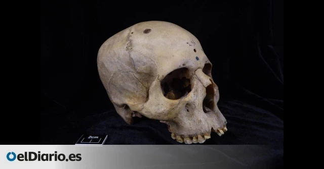 Hallan pruebas de la primera intervención médica de un cáncer en un cráneo egipcio de 4.500 años