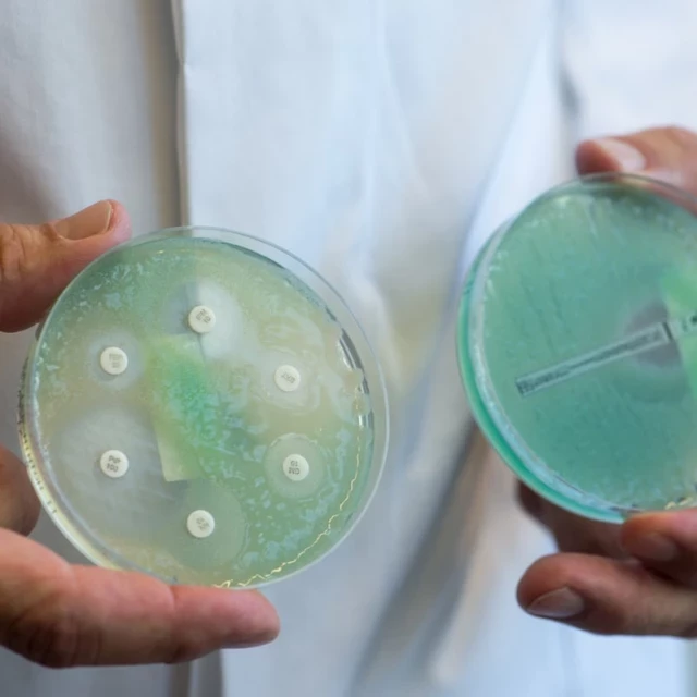 El ataque de los “clones epidémicos”: cómo una bacteria inofensiva llegó a causar medio millón de muertos al año