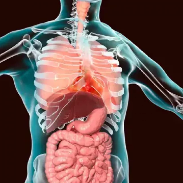 Qué ocurre en el cuerpo humano cuando los órganos están en el lugar equivocado