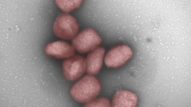 La OMS, en alerta ante la nueva cepa más letal del virus mpox: ya hay más de 450 muertes y continúa extendiéndose por África