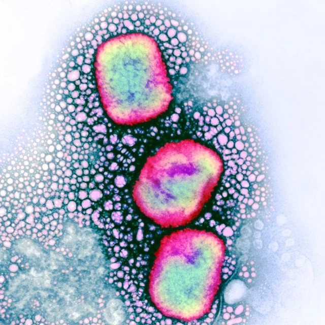 Datos básicos sobre la mpox o viruela del mono y cómo se contagia