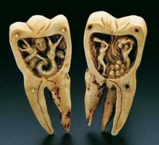 El Gusano de los Dientes como representación del tormento y el mito dental en el siglo XVIII [Eng]