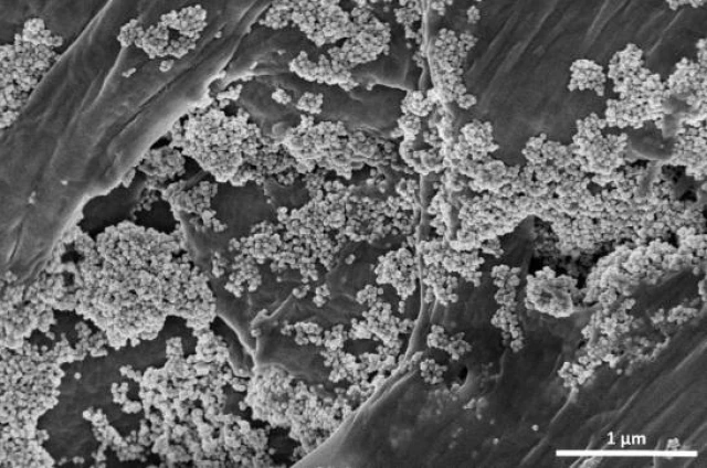 Eliminan microplásticos del agua con nanoflores de óxido de hierro