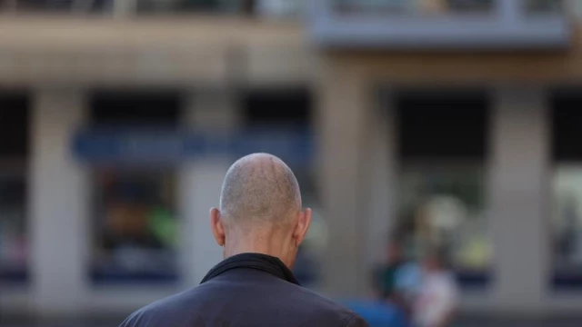 El "infierno" después de tomar una pastilla contra la alopecia