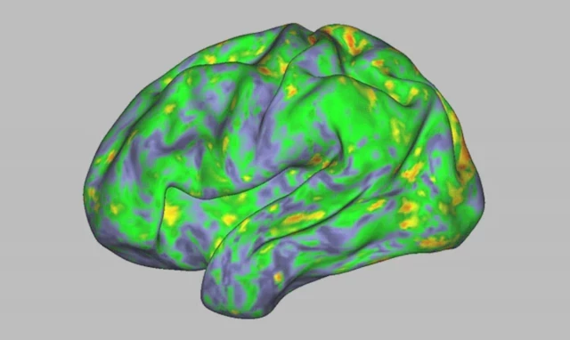 ¿Para qué sirve la psilocibina en salud mental?