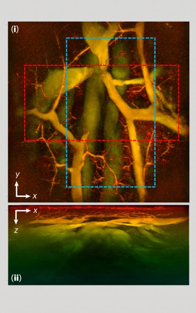 Revolución en la imagen médica: el escáner 3D fotoacústico óptico que podría transformar la medicina