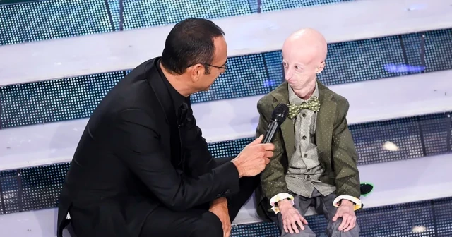 Murió Sammy Basso, el italiano de 28 años que visibilizó el síndrome de progeria que lo envejecía prematuramente