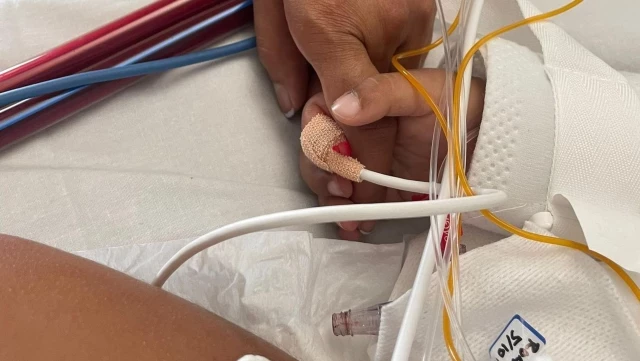 Un niño de Haro con un cacahuete incrustado en un pulmón salva la vida gracias a la coordinación entre hospitales y la conexión a un respirador artificial